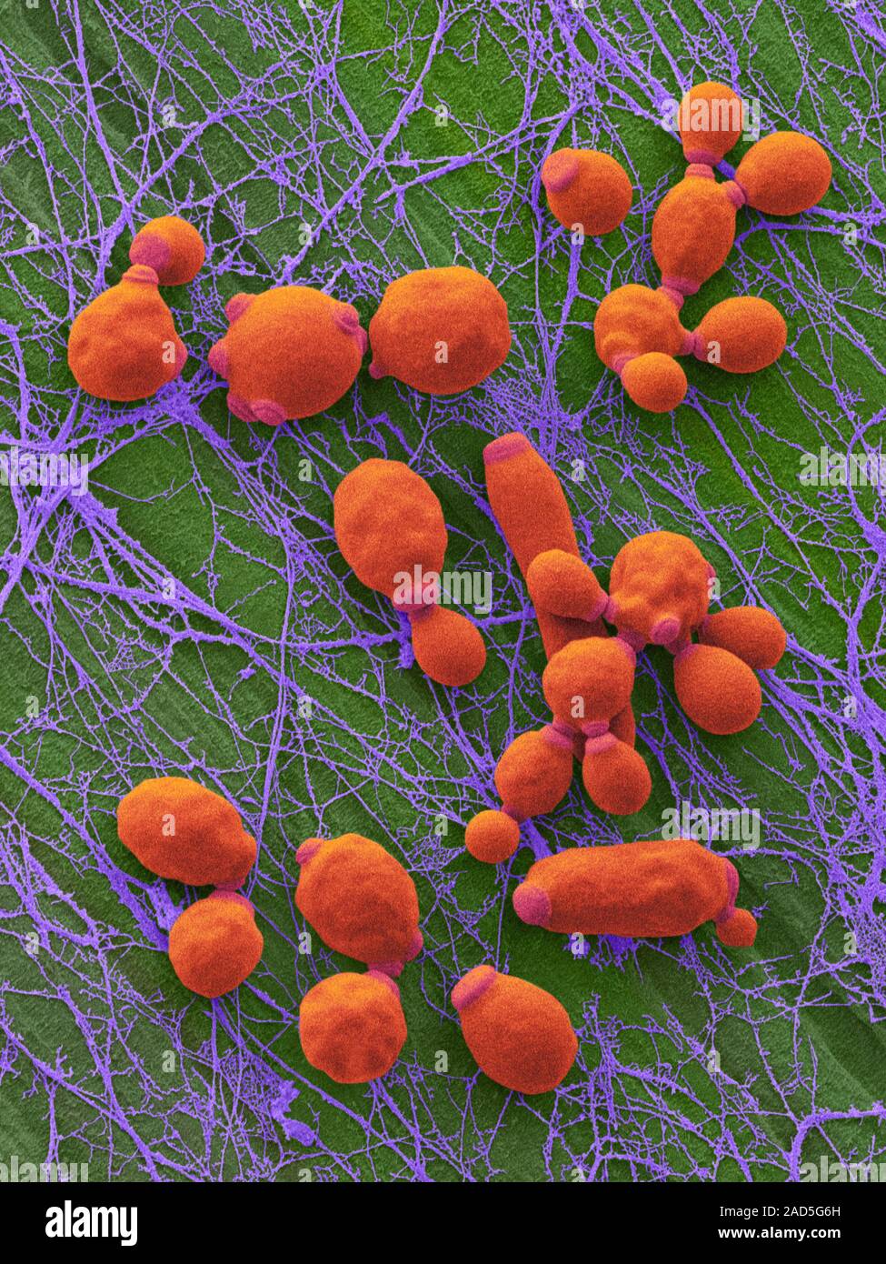 Coloured scanning electron micrograph (SEM) of Candida albicans
