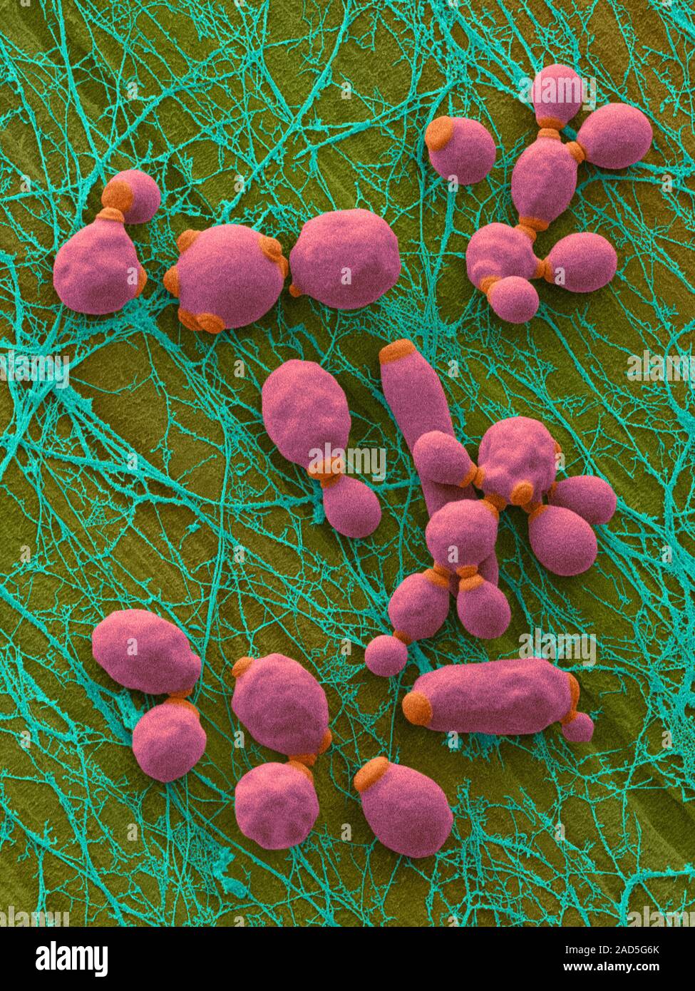 Coloured scanning electron micrograph (SEM) of Candida albicans