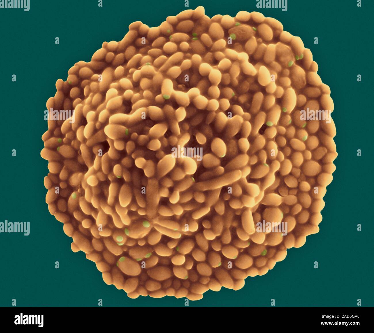 Coloured scanning electron micrograph (SEM) of Yeast Colony (Saccharomyces cerevisiae