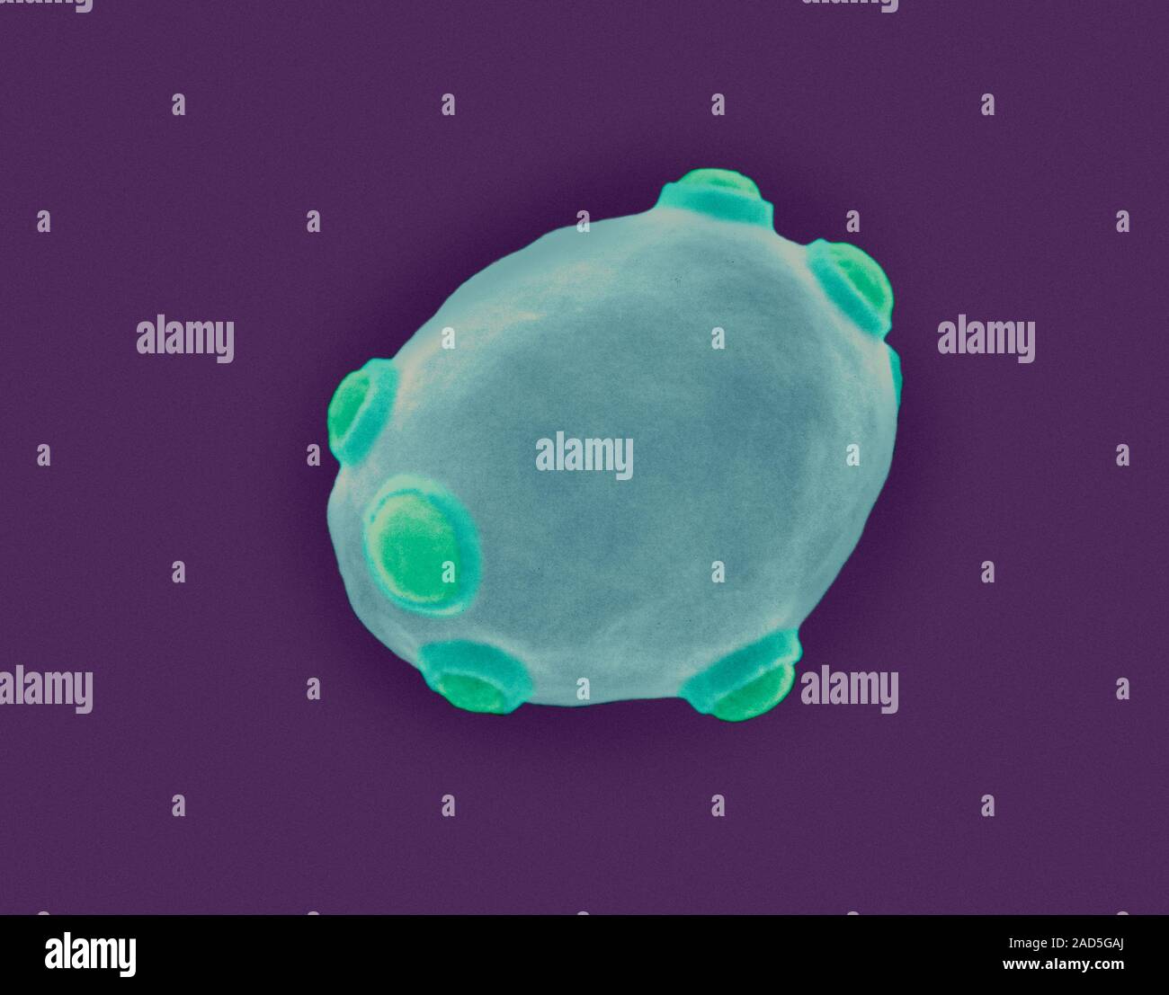Coloured scanning electron micrograph (SEM) of brewer's yeast with bud