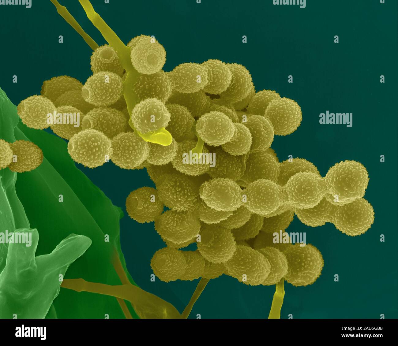Coloured scanning electron micrograph (SEM) of Fungal mould spores on a ...