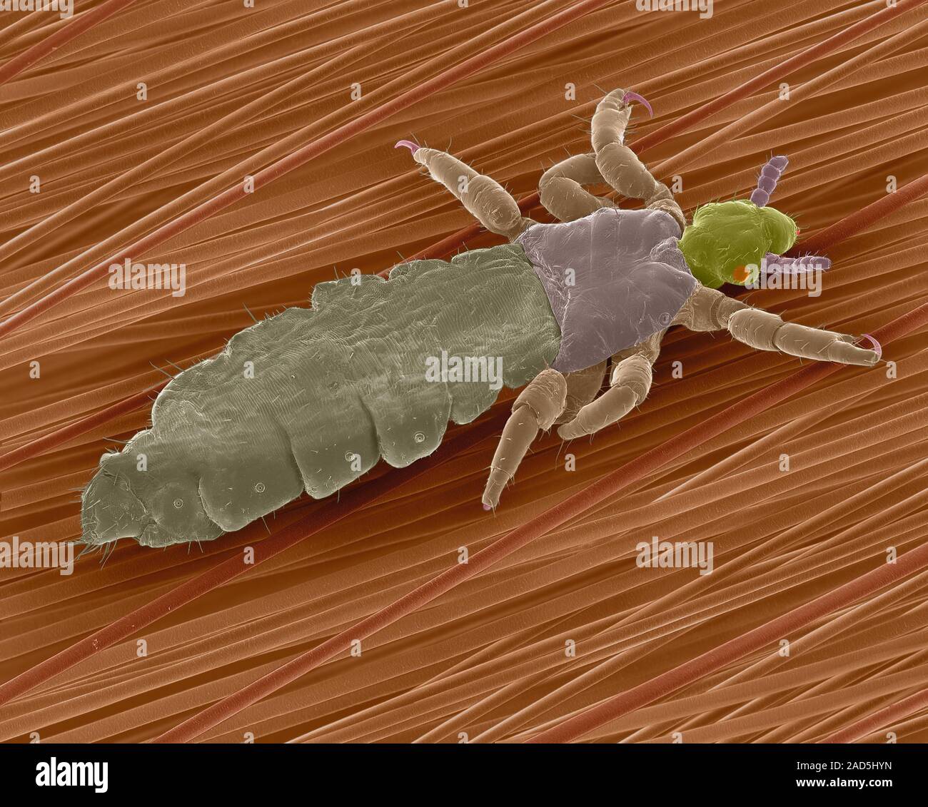 Coloured scanning electron micrograph (SEM) of Human head louse on ...