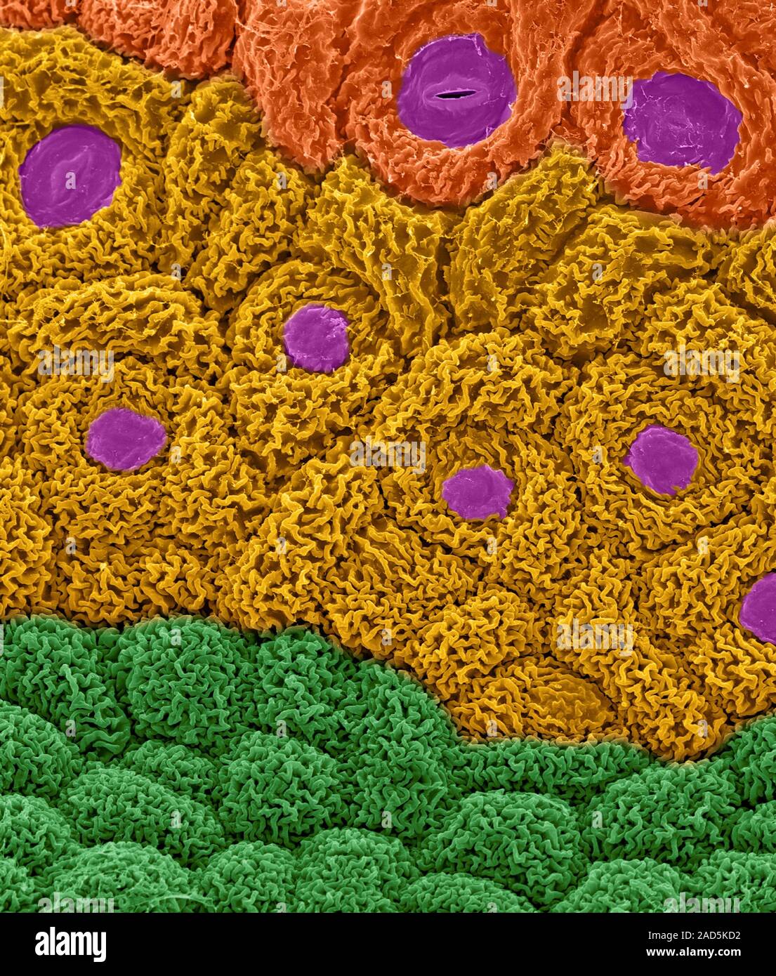 Differentiating meristem region of a broccoli flower bud (Brassica ...