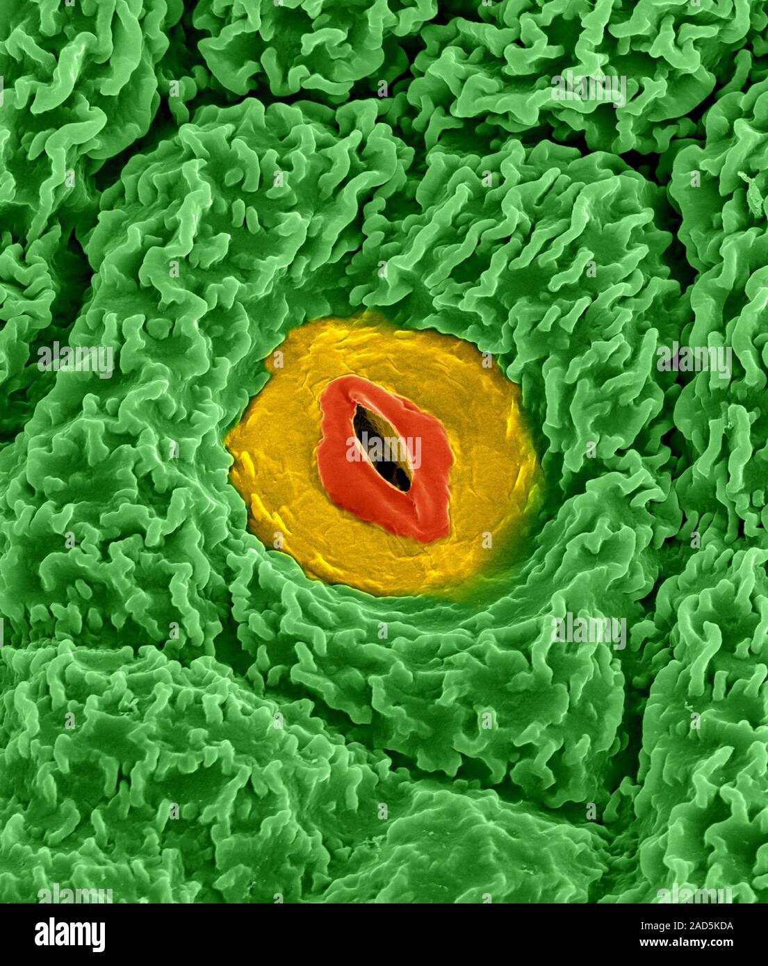 Differentiating meristem region of a broccoli flower bud (Brassica