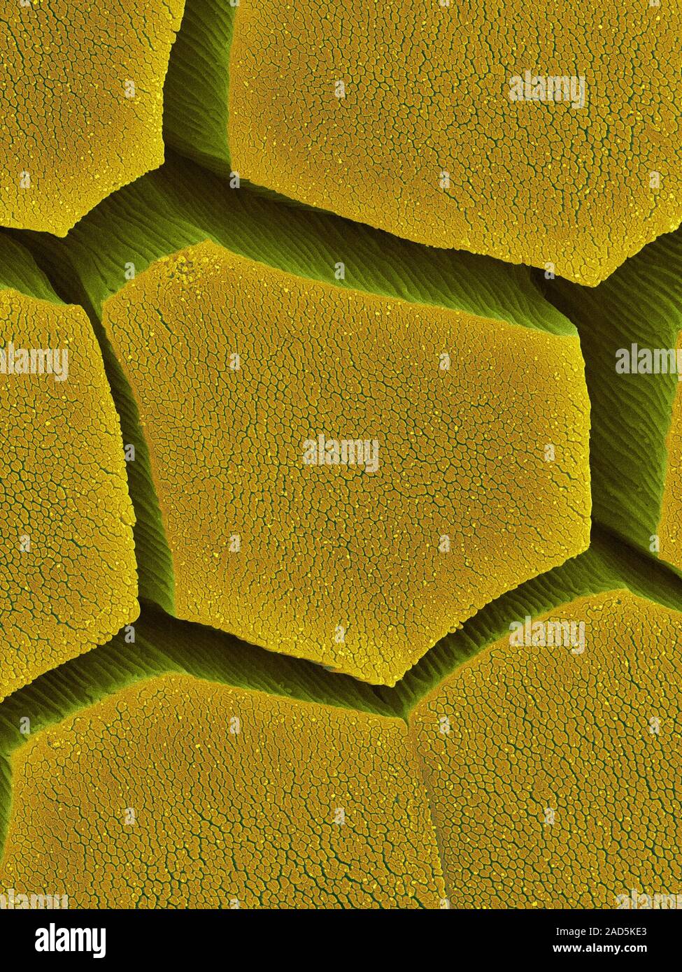 Coloured scanning electron micrograph (SEM) Coqui frog toe pad