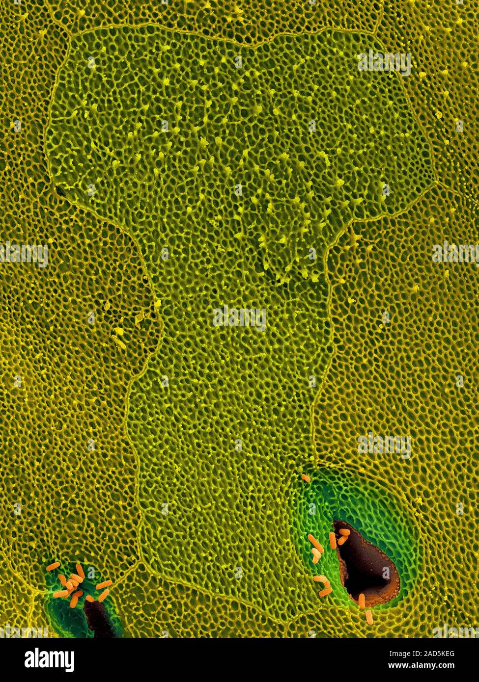 Coloured scanning electron micrograph (SEM) Coqui frog skin and