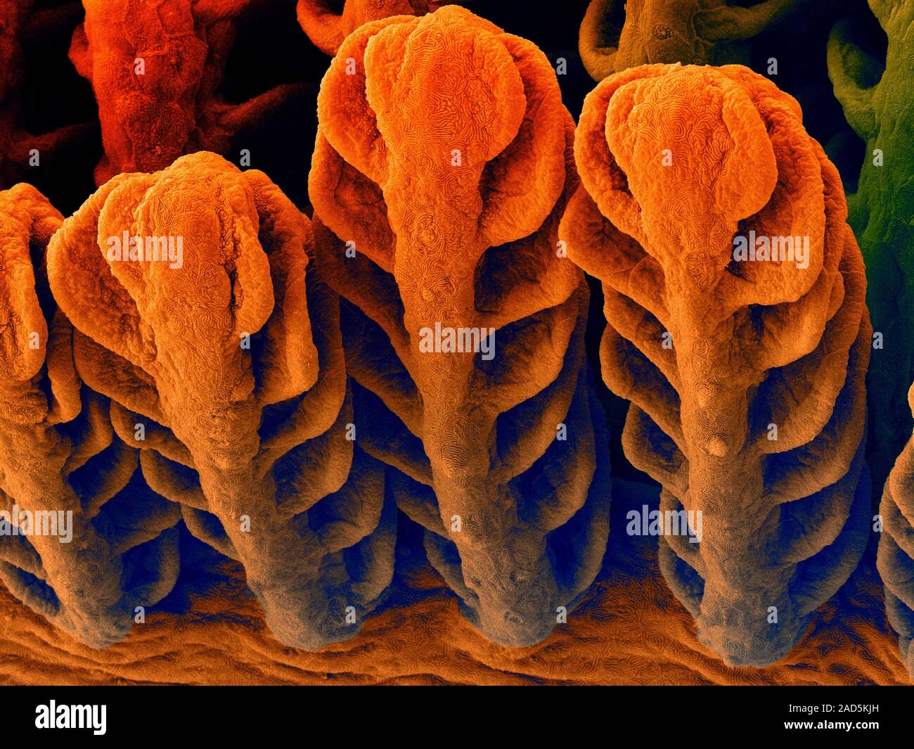 Coloured scanning electron micrograph (SEM) Fresh water goby (Awaous ...