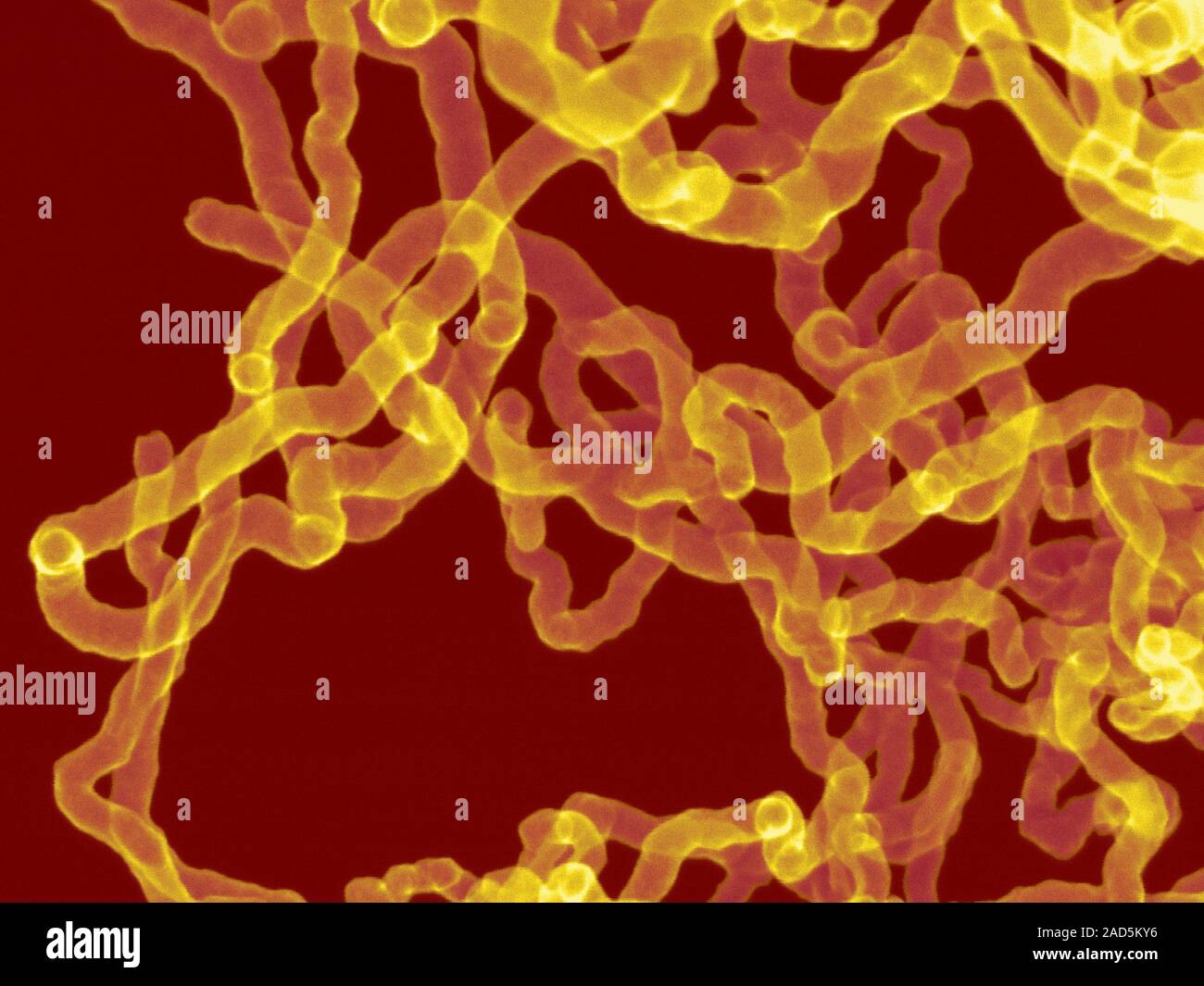 Coloured scanning electron micrograph (SEM) of Carbon nanotubes. Carbon ...
