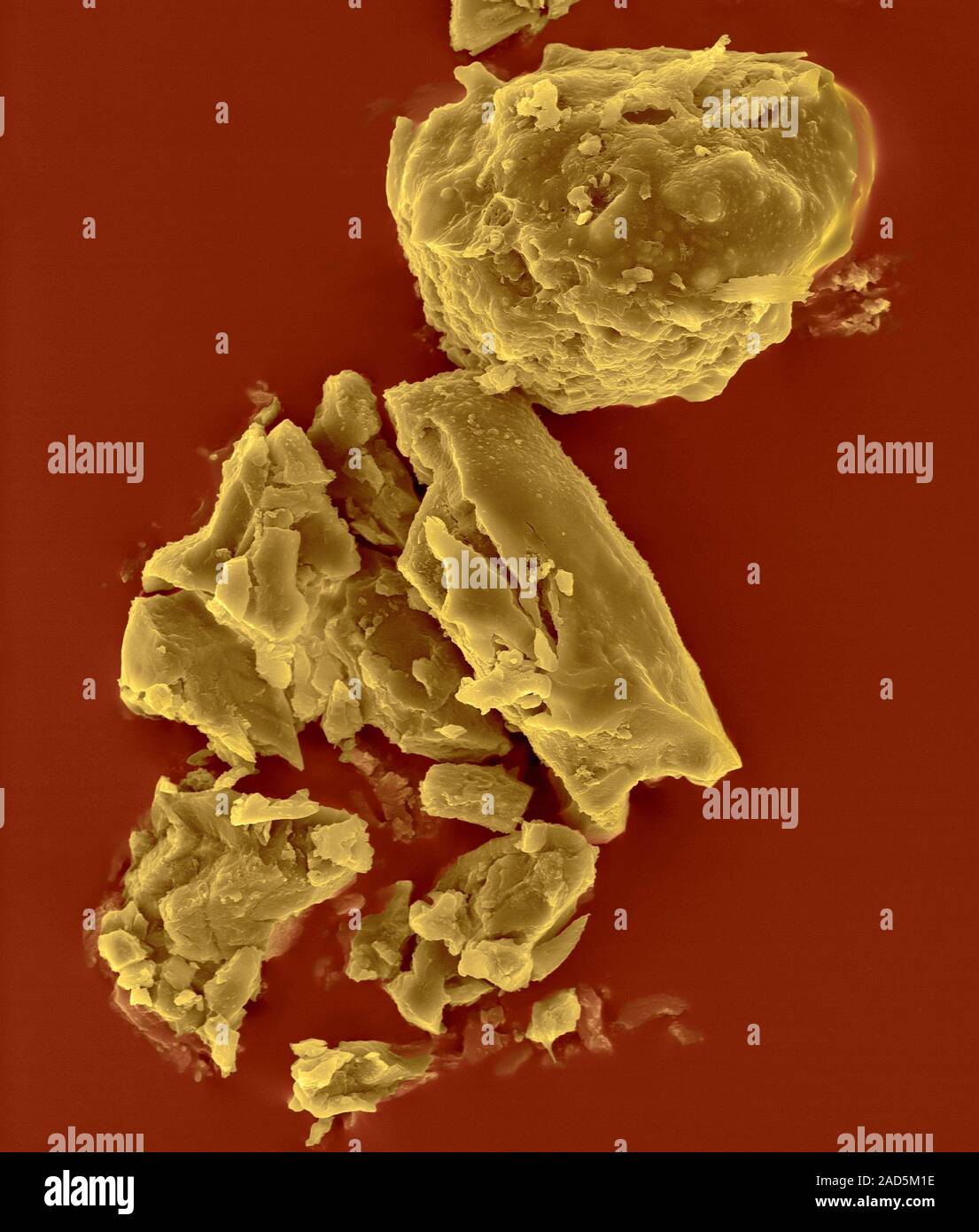 Coloured scanning electron micrograph (SEM) of Soot (carbon) particles from the inside of a wood