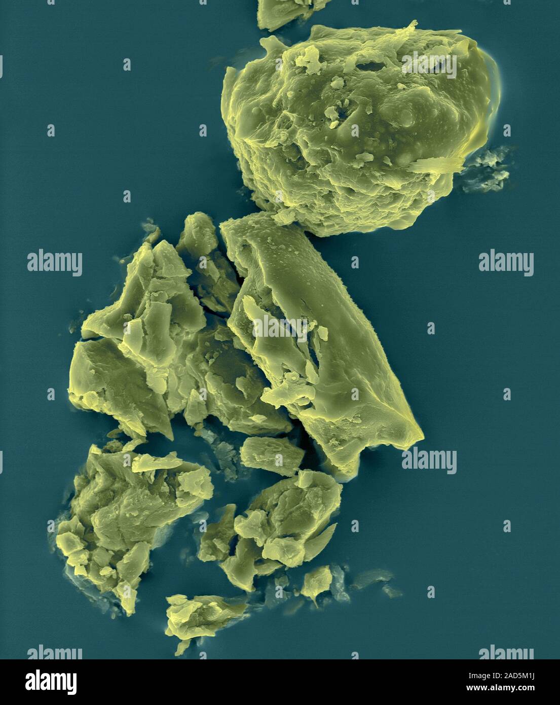 Coloured scanning electron micrograph (SEM) of Soot (carbon) particles