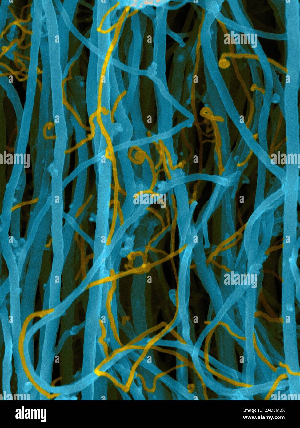Coloured scanning electron micrograph (SEM) of carbon nanotubes (single ...