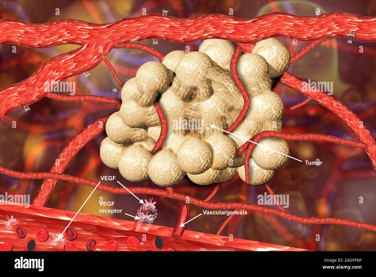 Blood vessel formation. Illustration showing malignant (cancerous