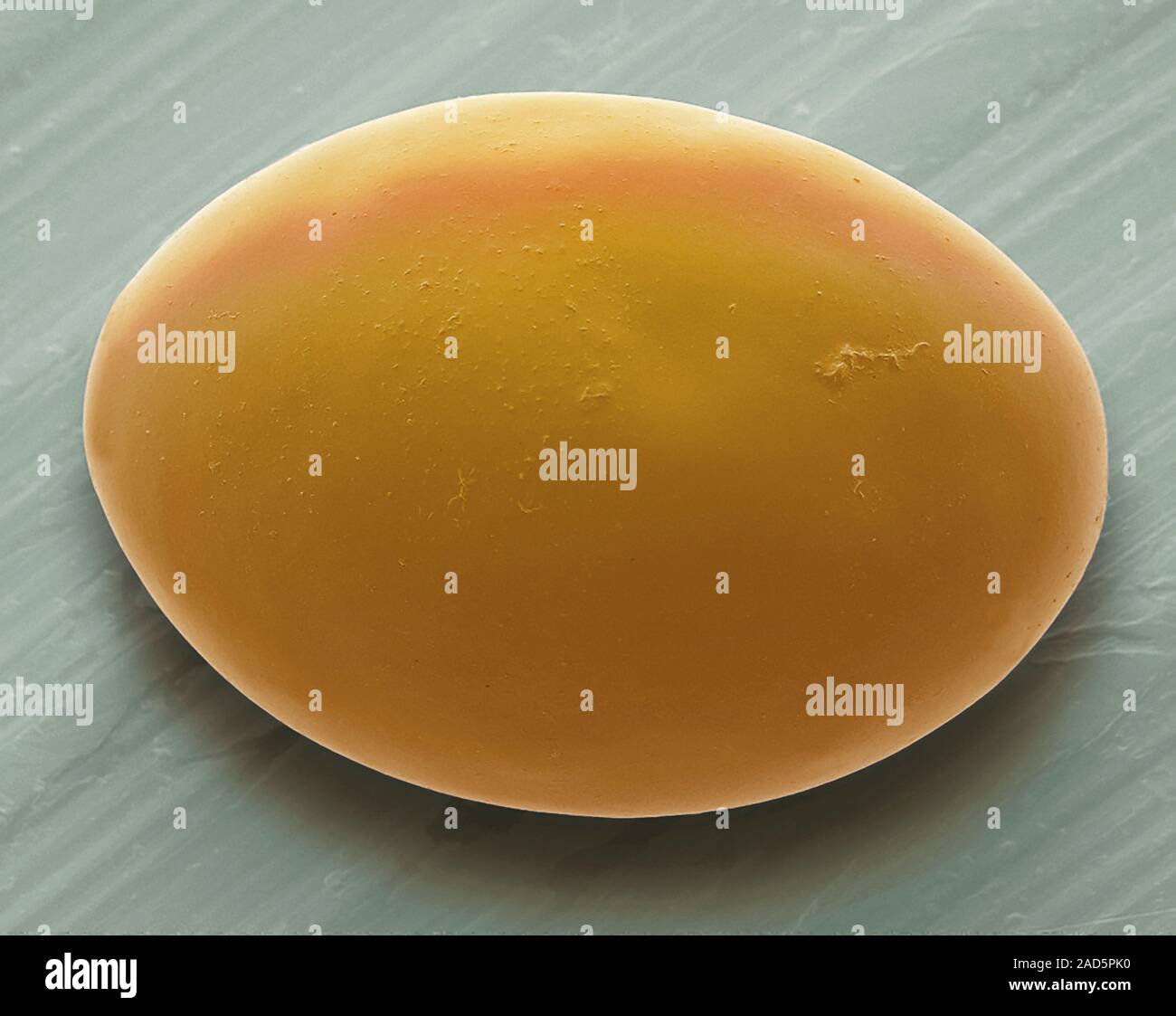 Tapeworm egg. Coloured scanning electron micrograph (SEM). Tapeworms