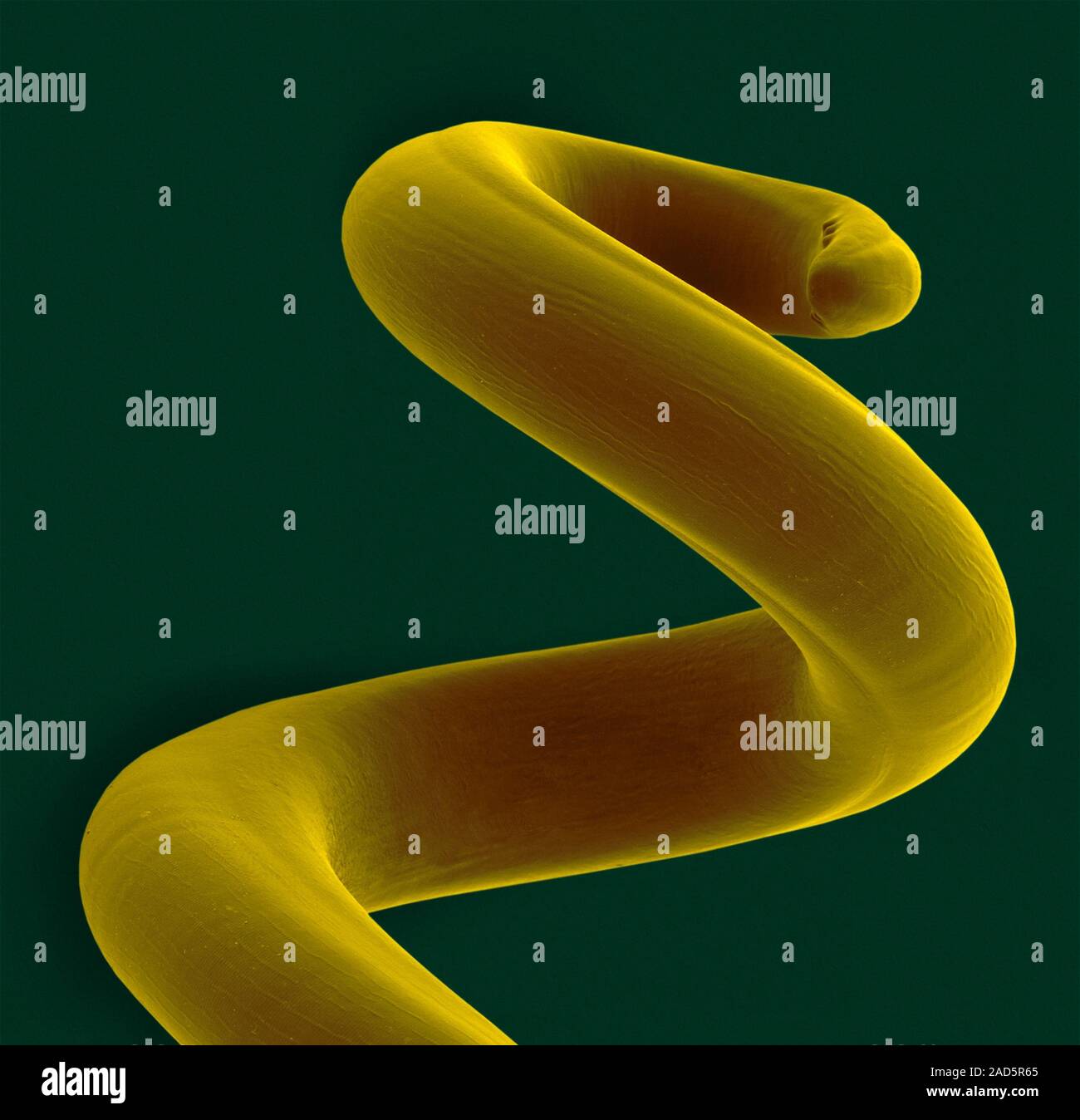 Coloured scanning electron micrograph (SEM) of a dog lungworm