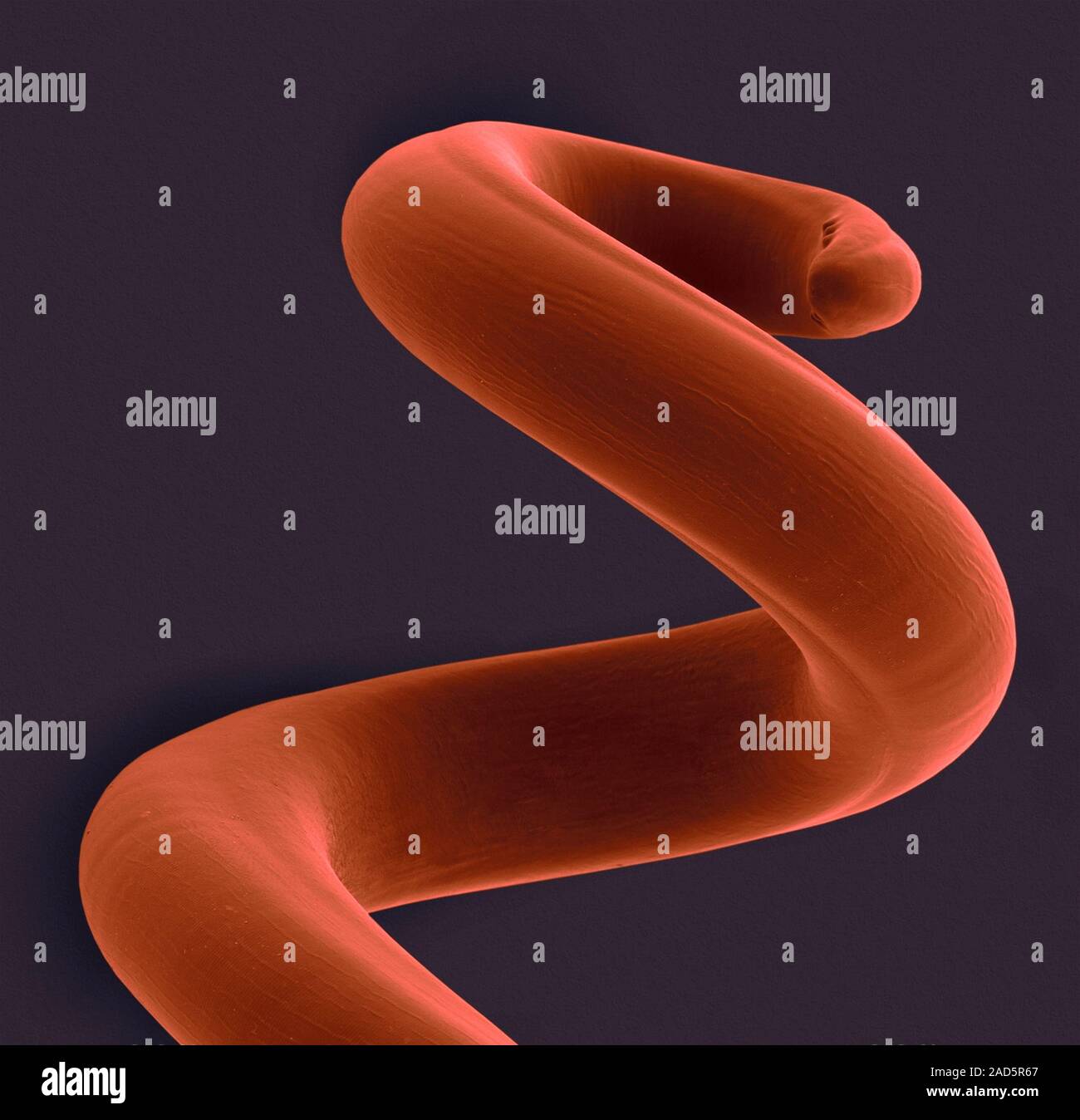 Coloured scanning electron micrograph (SEM) of a dog lungworm