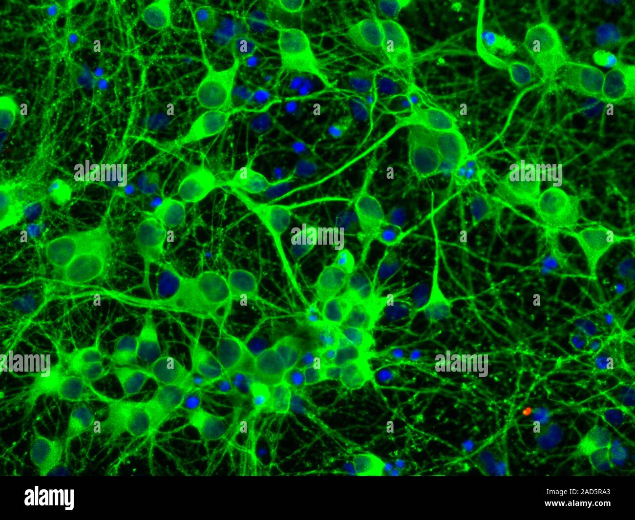 Brain hippocampus neurons, fluorescence light micrograph. The ...