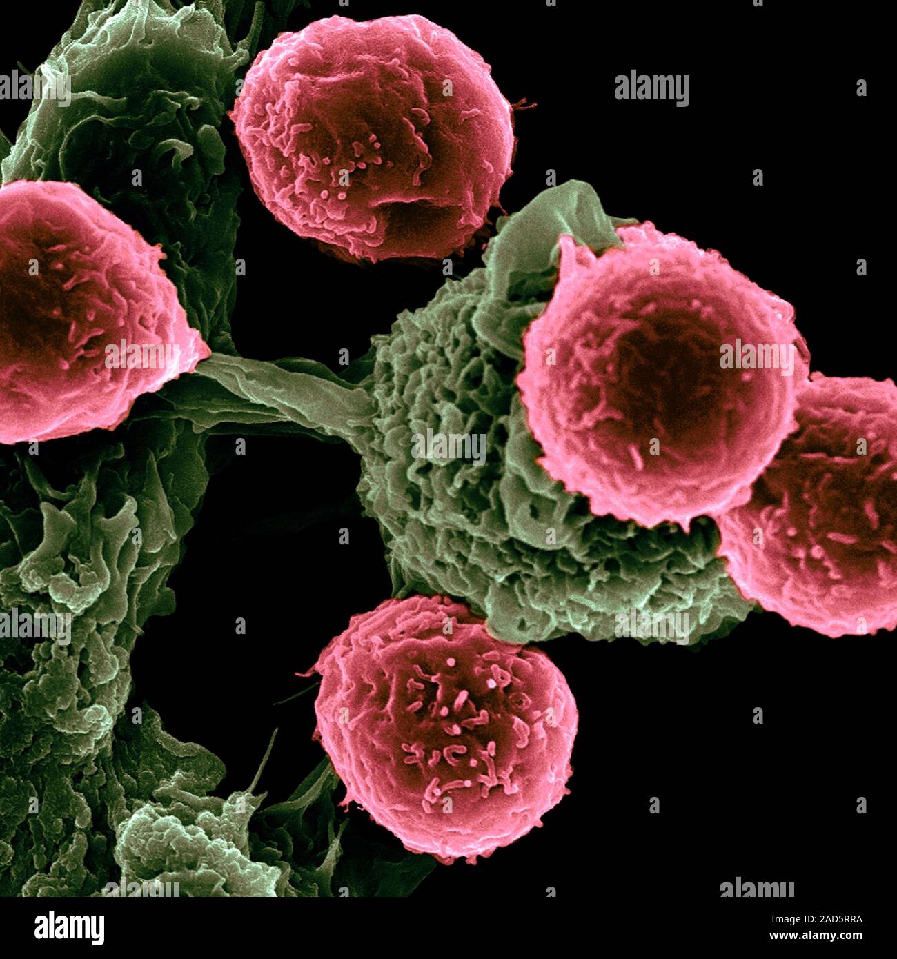 Nanoparticle cancer treatment research. Coloured scanning electron ...