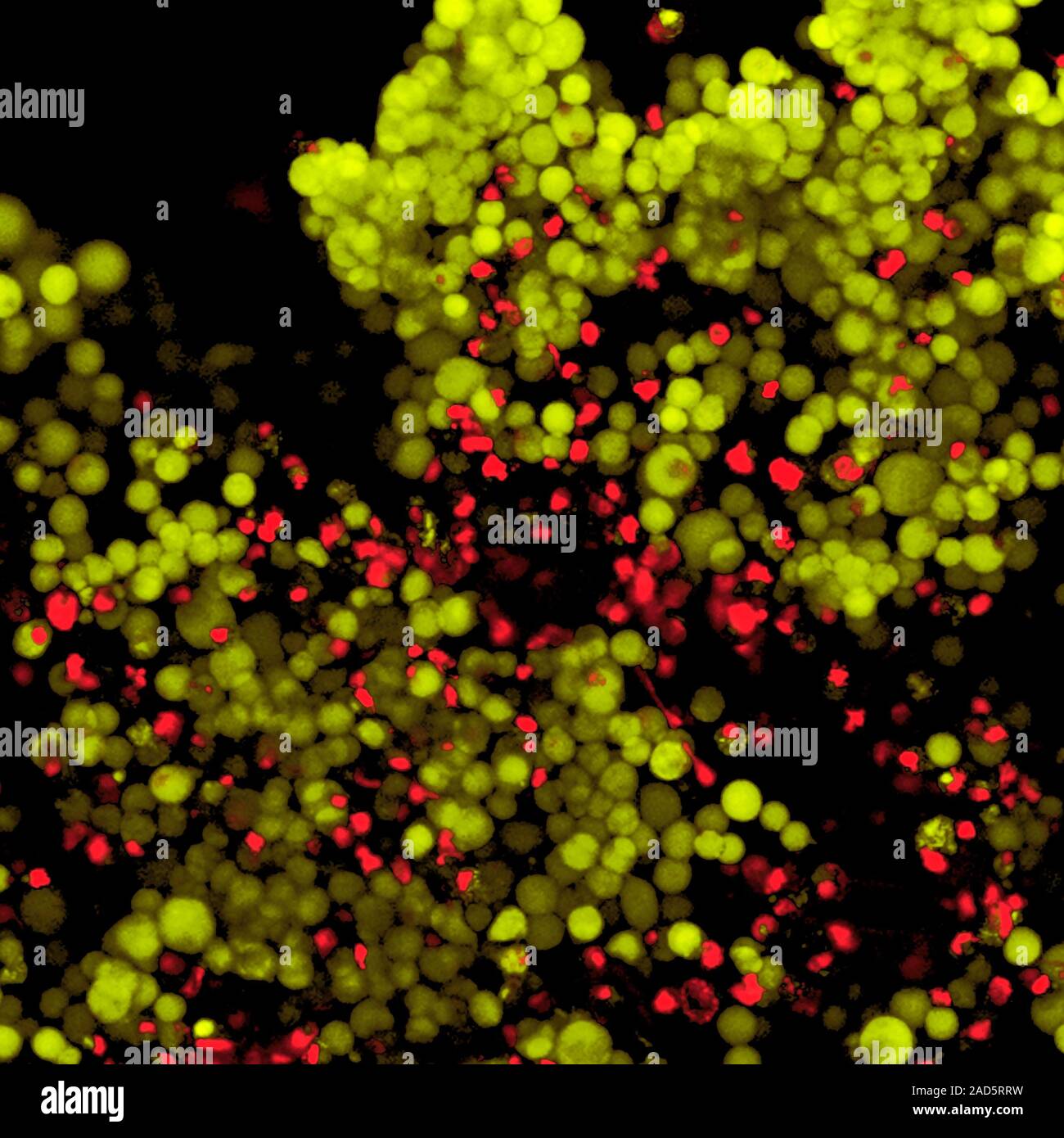 Nanoparticle cancer treatment research. Fluorescence micrograph showing ...