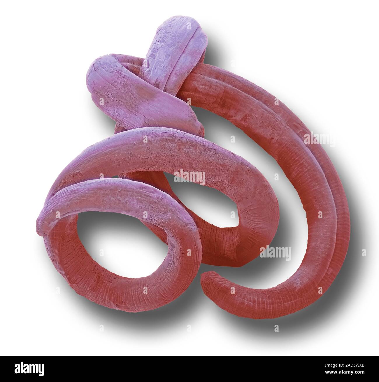 Threadworm, coloured scanning electron micrograph (SEM). This is a