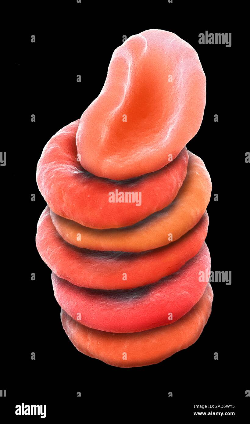 Red blood cells in the Rouleau formation, coloured scanning electron