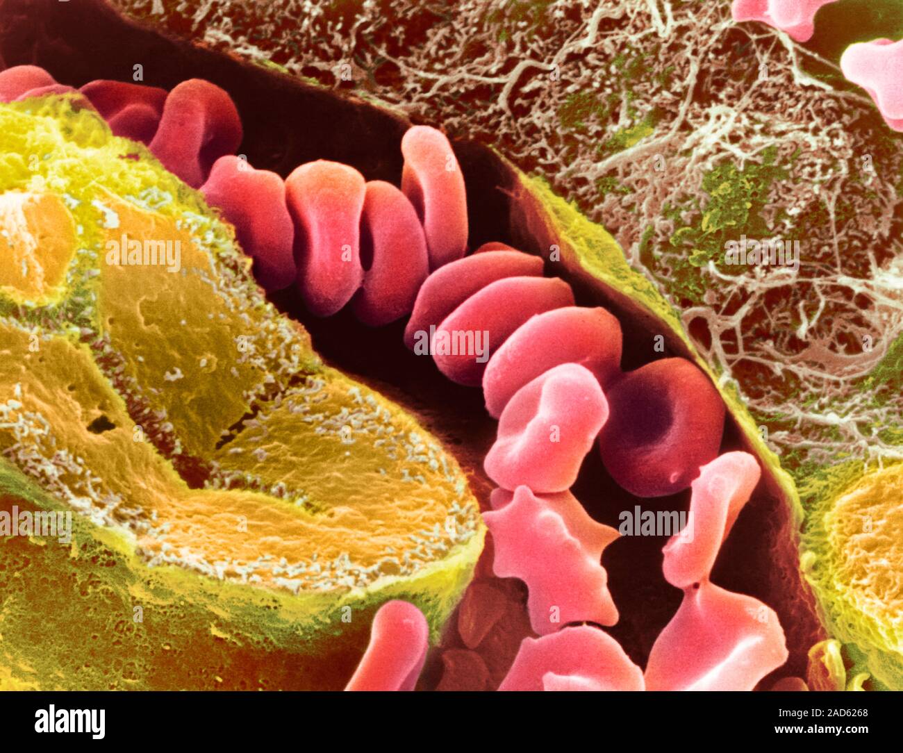 Liver capillary. Coloured scanning electron micrograph (SEM) of a ...