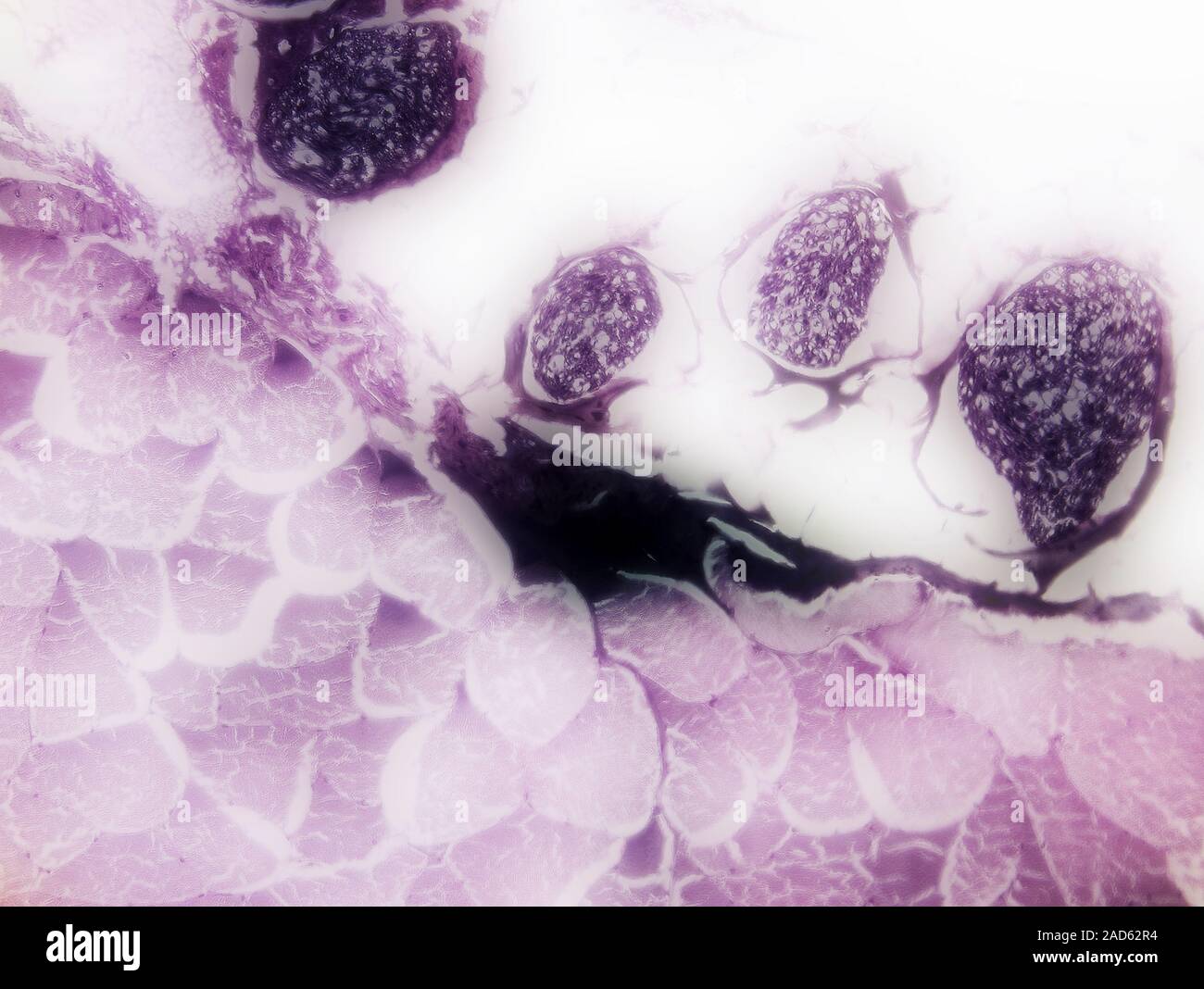 Skeletal muscle and nerve bundles. Digitally enhanced light micrograph ...