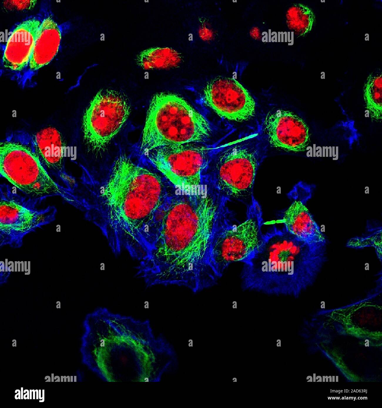 HeLa cervical cancer cells. Fluorescence light micrograph of HeLa ...