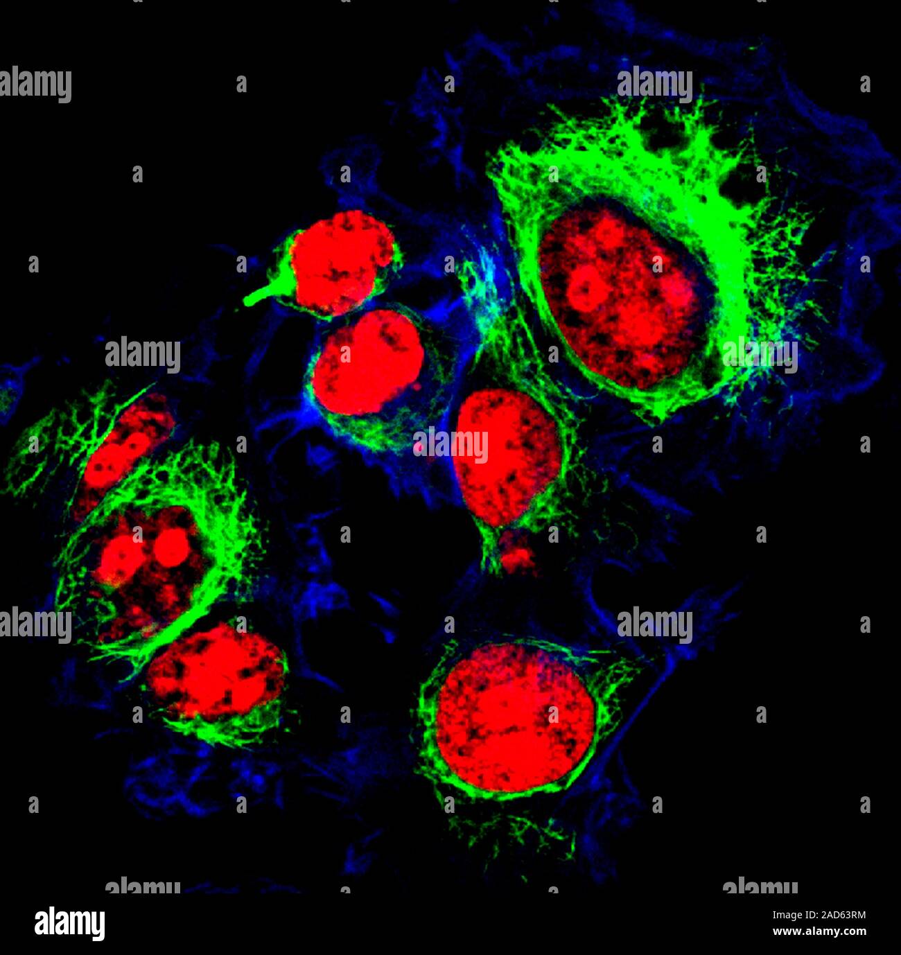 HeLa cervical cancer cells. Fluorescence light micrograph of HeLa ...
