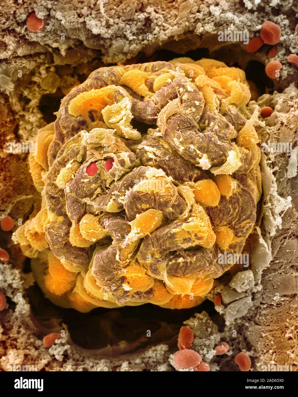 Kidney glomerulus (podocytes and capillaries of the renal corpuscle ...
