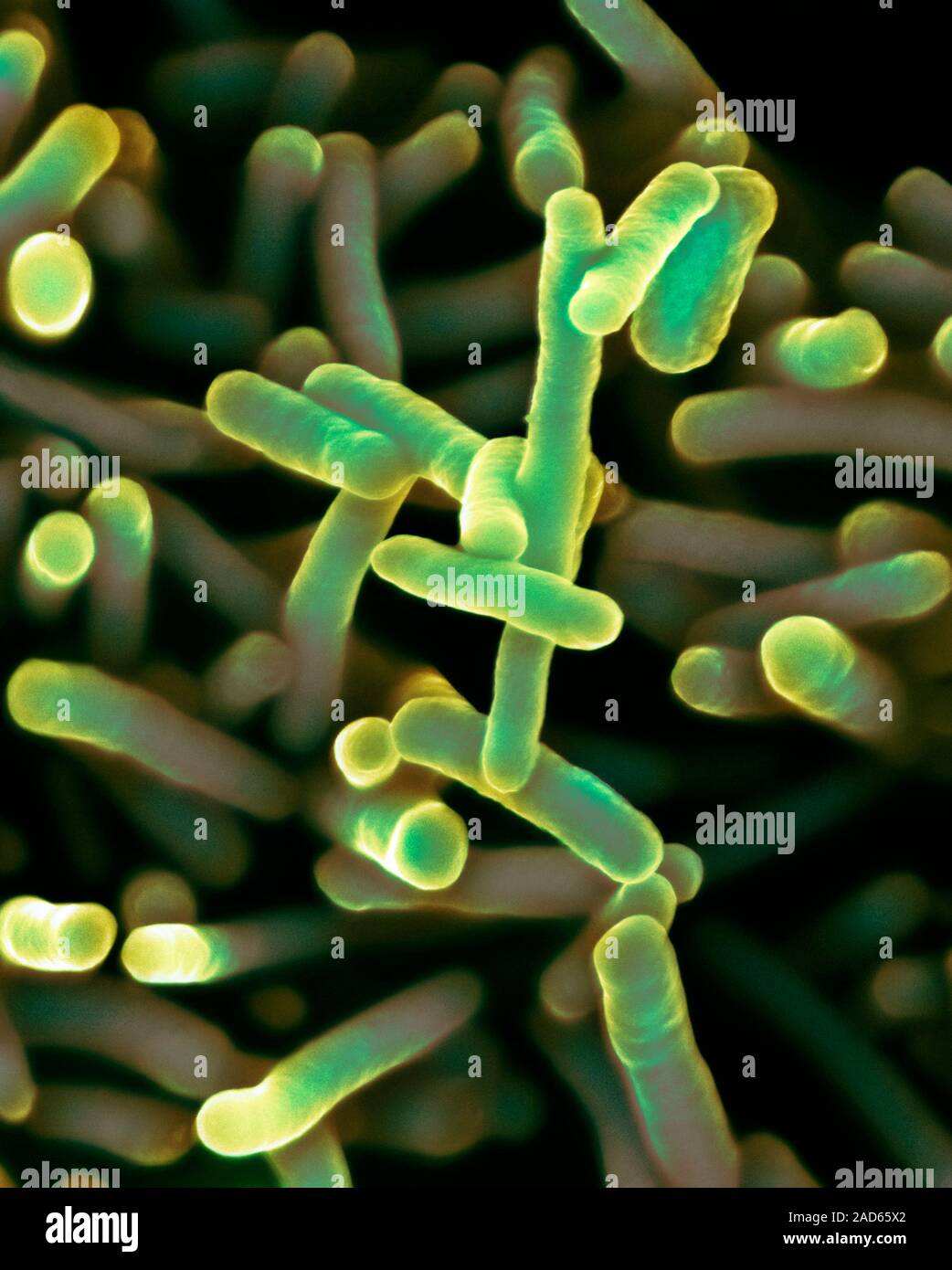 Бацилла шигелла. Дизентерии (shigella dysenteriae). Шигеллы зонне. Возбудитель шигелла микробиология. Бактерия шигелла дизентерия.