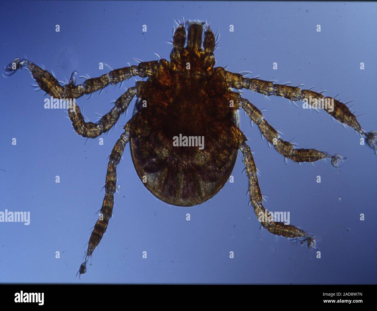 Blood-sucking arachnids greatly enlarged Stock Photo