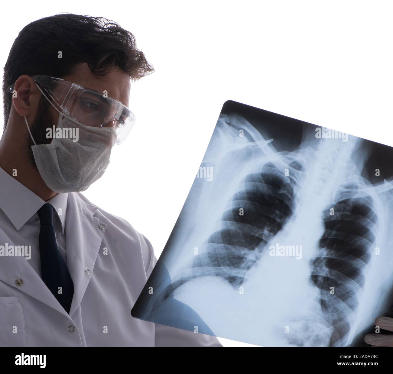 Young doctor looking at x-ray images isolated on white Stock Photo - Alamy