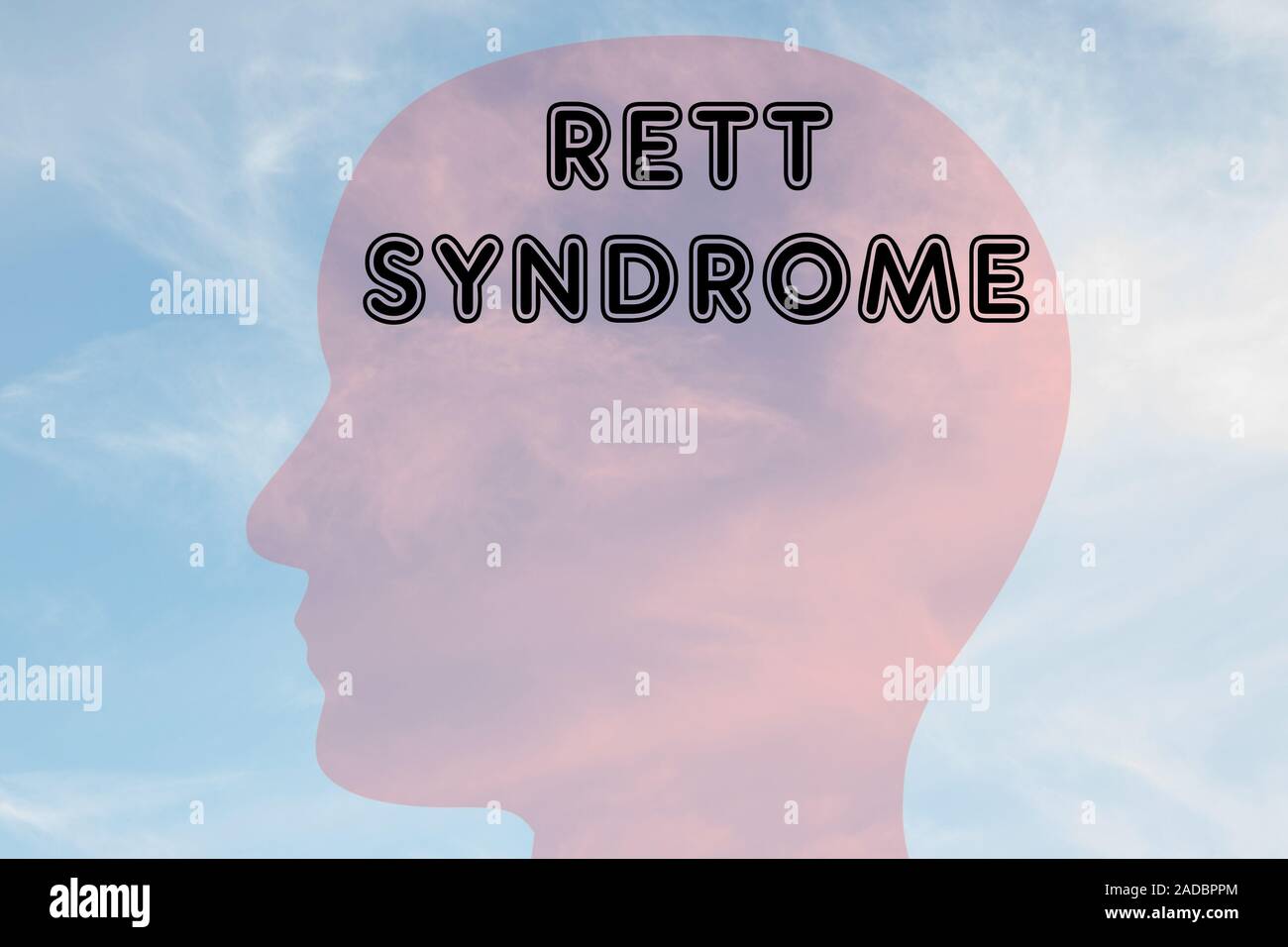 Render illustration of RETT SYNDROME title on head silhouette, with cloudy sky as a background. Stock Photo