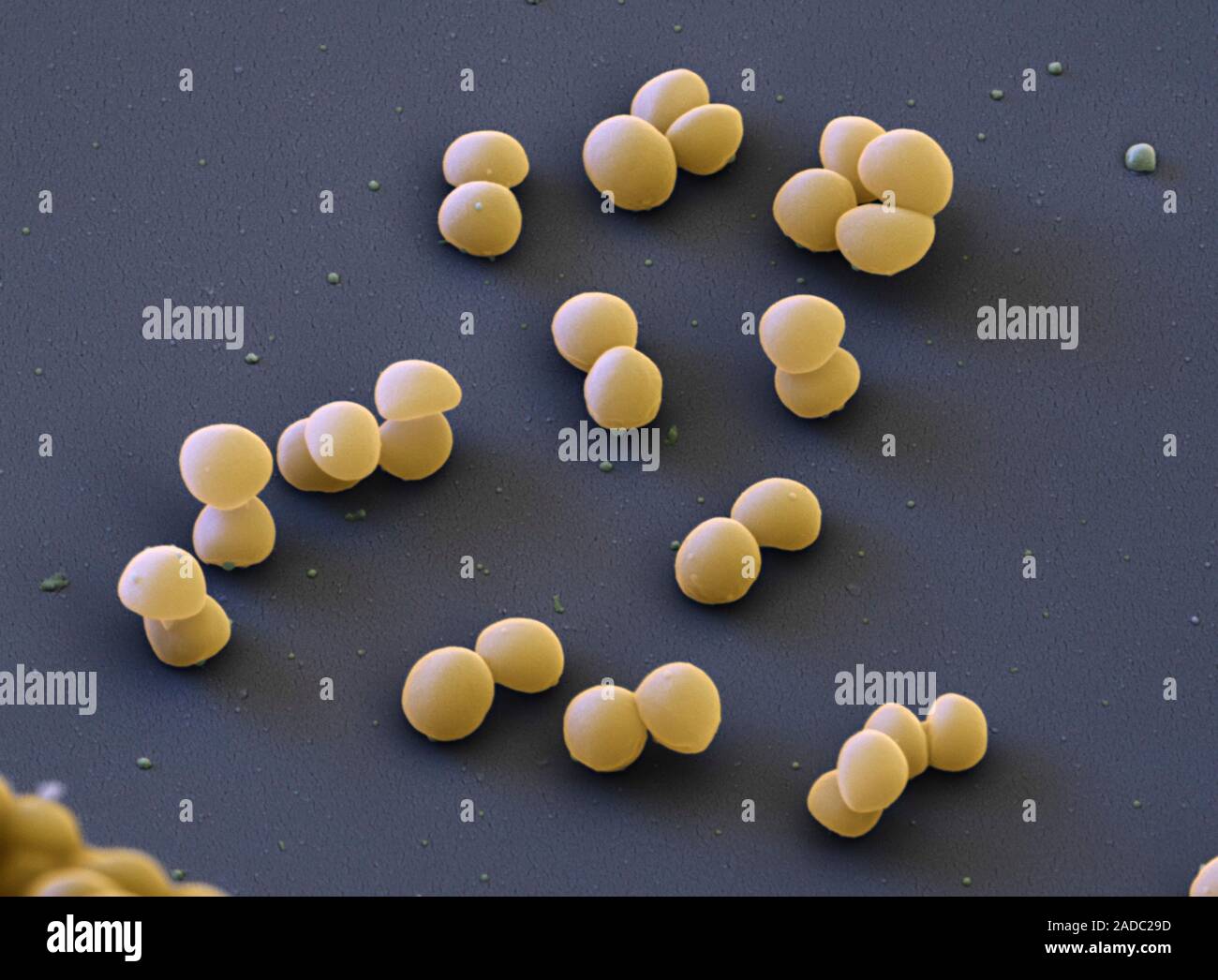 Staphylococcus lugdunensis bacteria, coloured scanning electron ...