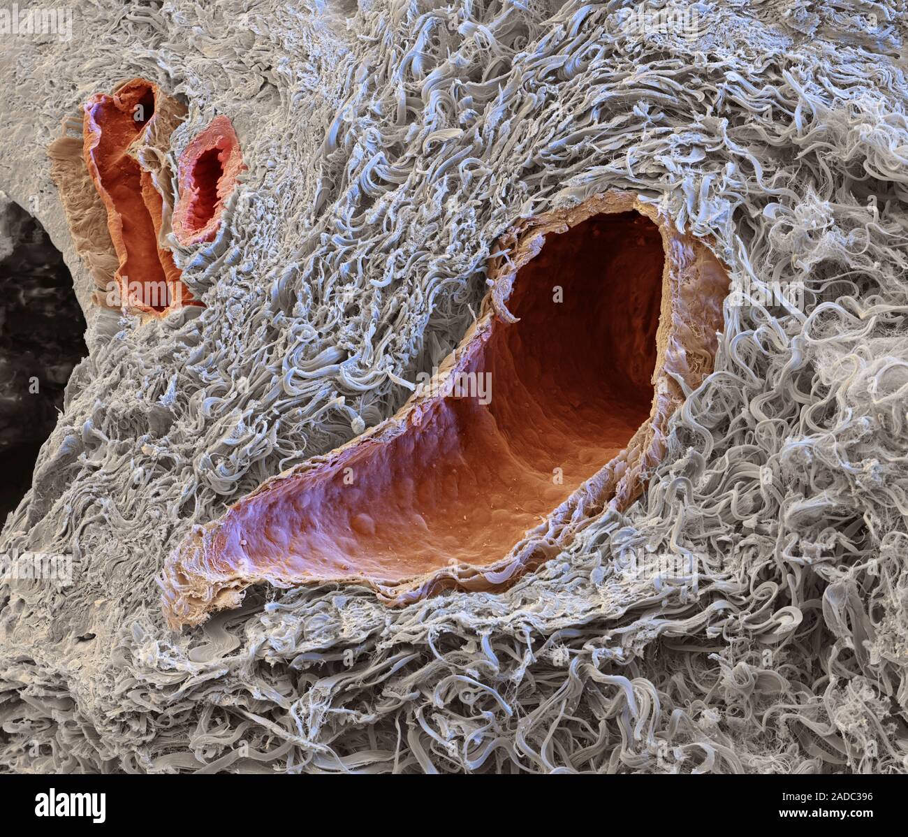 Blood vessels. Coloured scanning electron micrograph (SEM) of a freeze ...