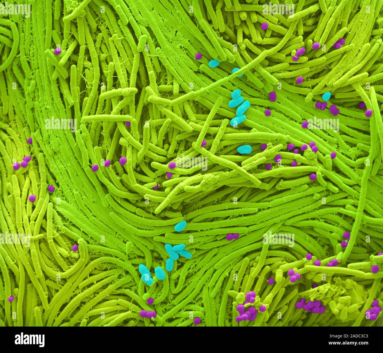 Nasal bacterial culture. Coloured scanning electron micrograph (SEM) of ...