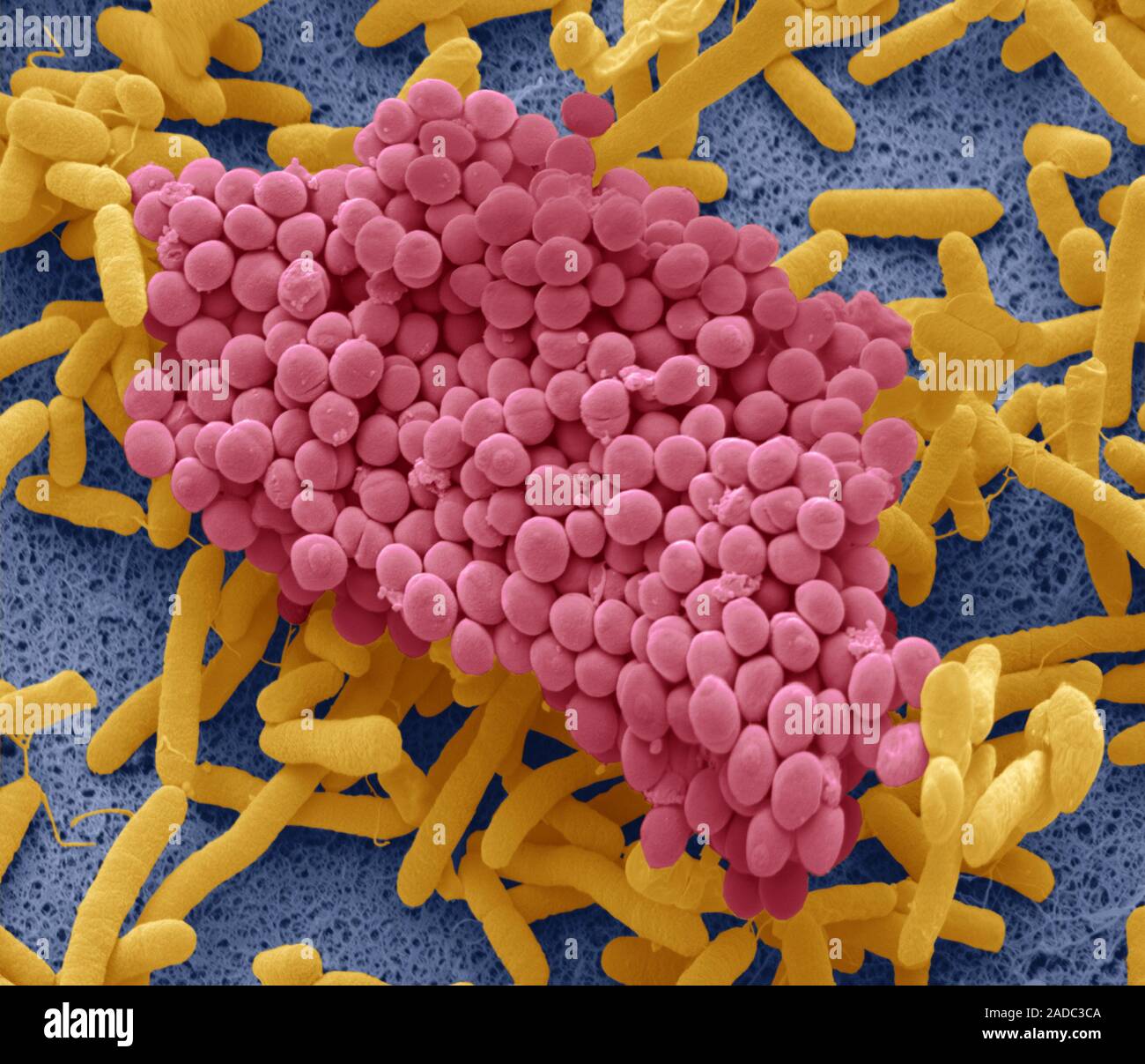 Coloured scanning electron micrograph (SEM) of bacteria cultured from a ...