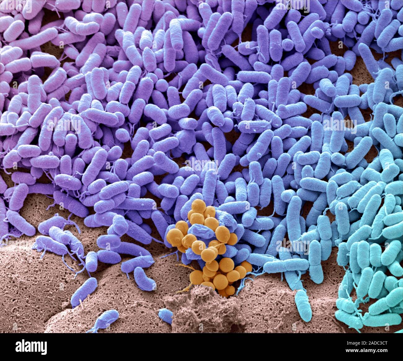 Coloured scanning electron micrograph (SEM) of bacteria cultured from a ...