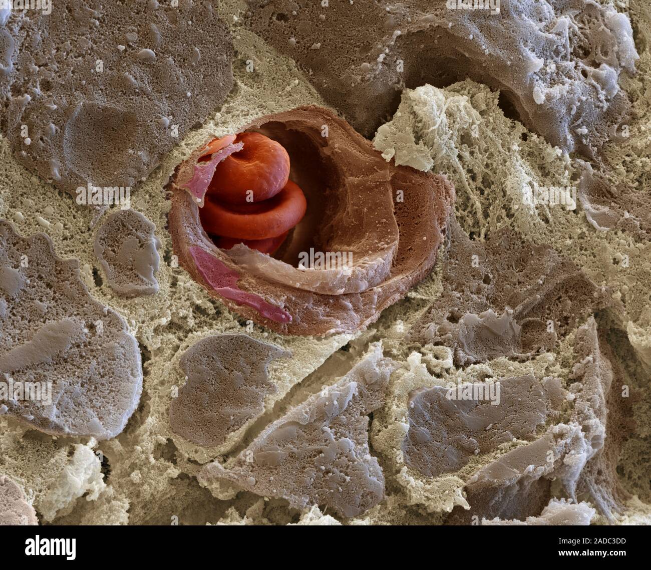 Capillary and red blood cells. Coloured scanning electron micrograph ...