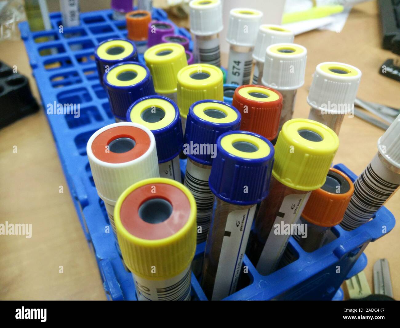 Young girl of six having blood drawn from her arm for a blood test