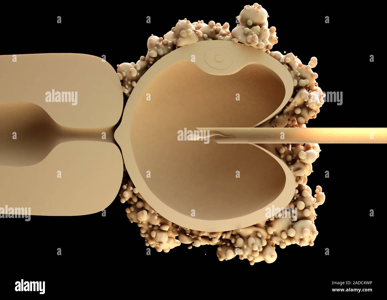 ICSI in vitro fertilisation. Computer illustration of a human egg cell