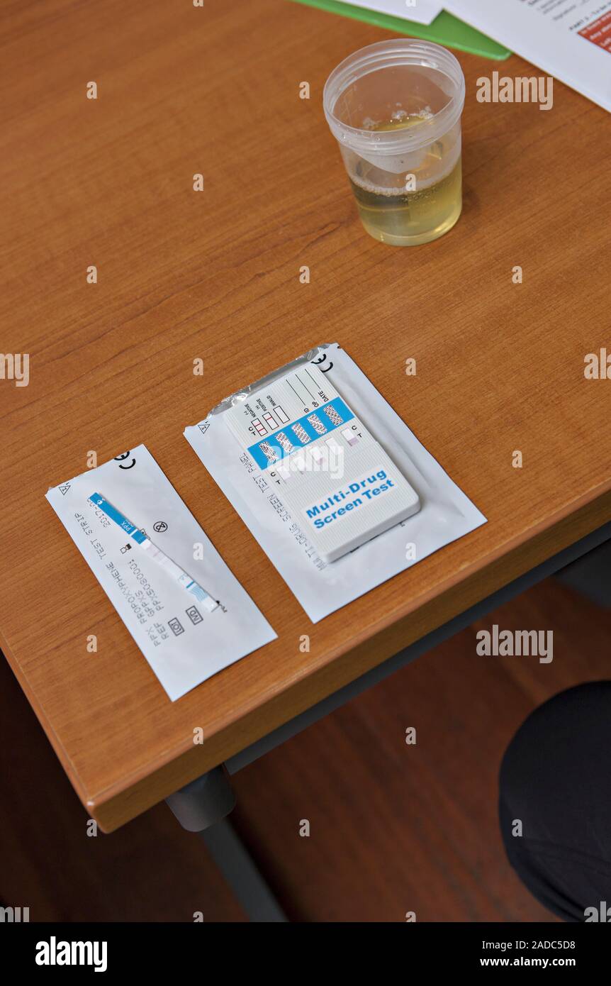 Urine multidrug test kit and sample. This 5panel urine drug screening
