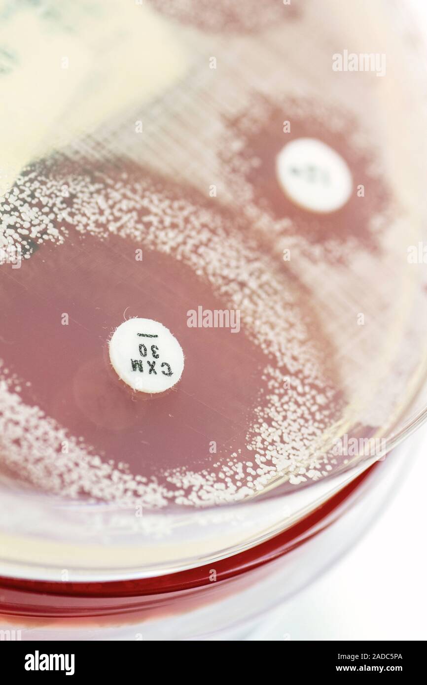 Staphylococcus culture and antibiotics. Petri dish culture of a mixed culture of Staphylococcus
