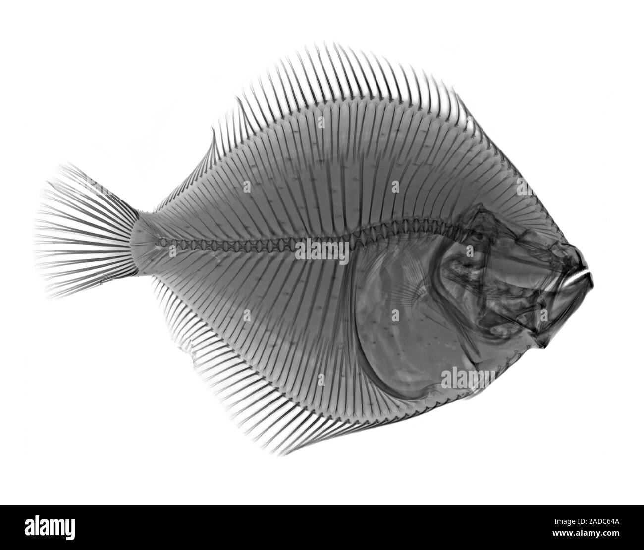 turbot-scophthalmus-maximus-x-ray-stock-photo-alamy