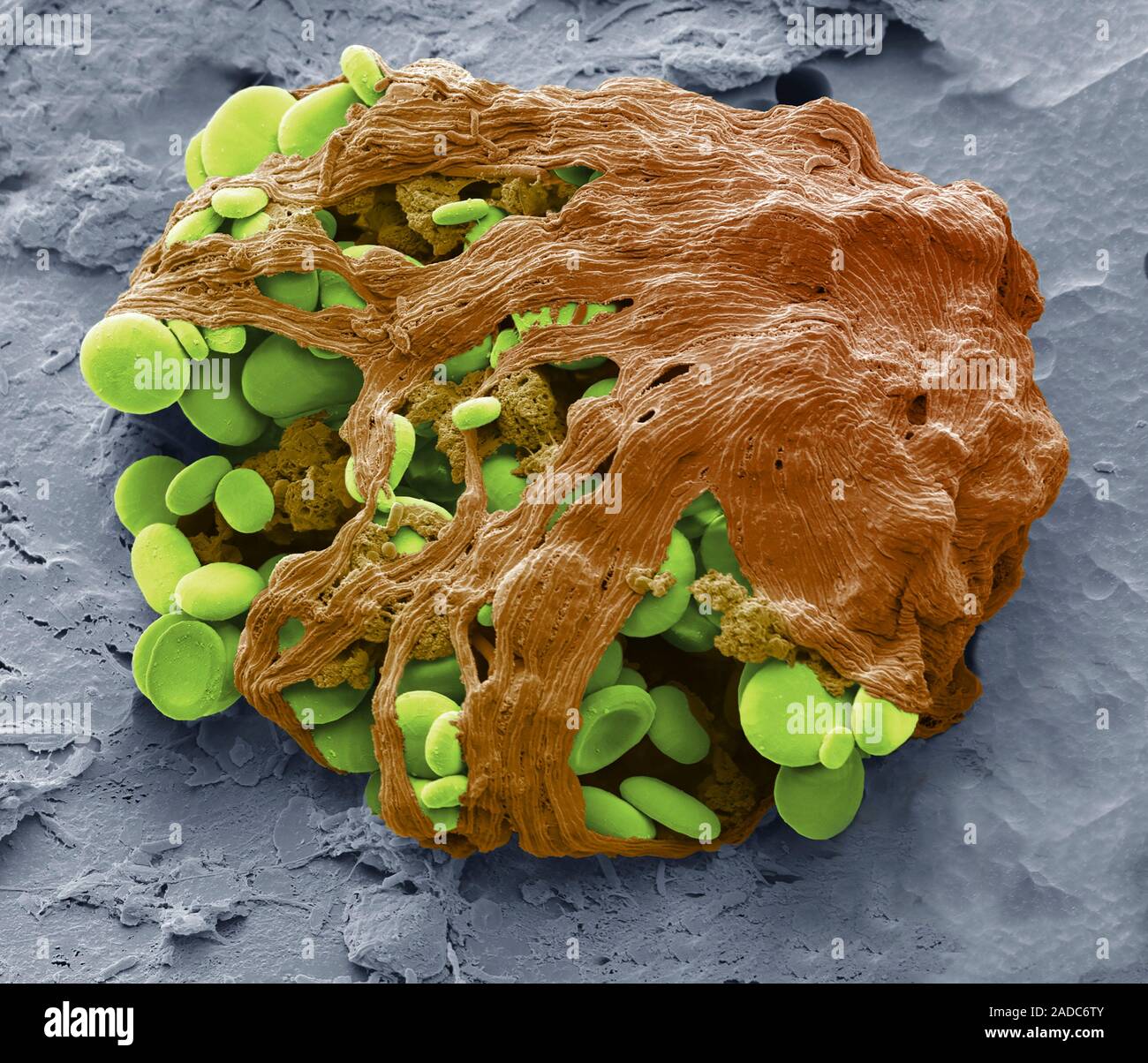 Euglena chloroplasts. Scanning electron micrograph (SEM). of a dying ...