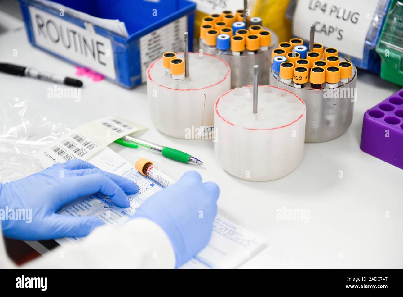 Handling Lab Sample Pathology sample analysis. Technician handling samples that are being ...