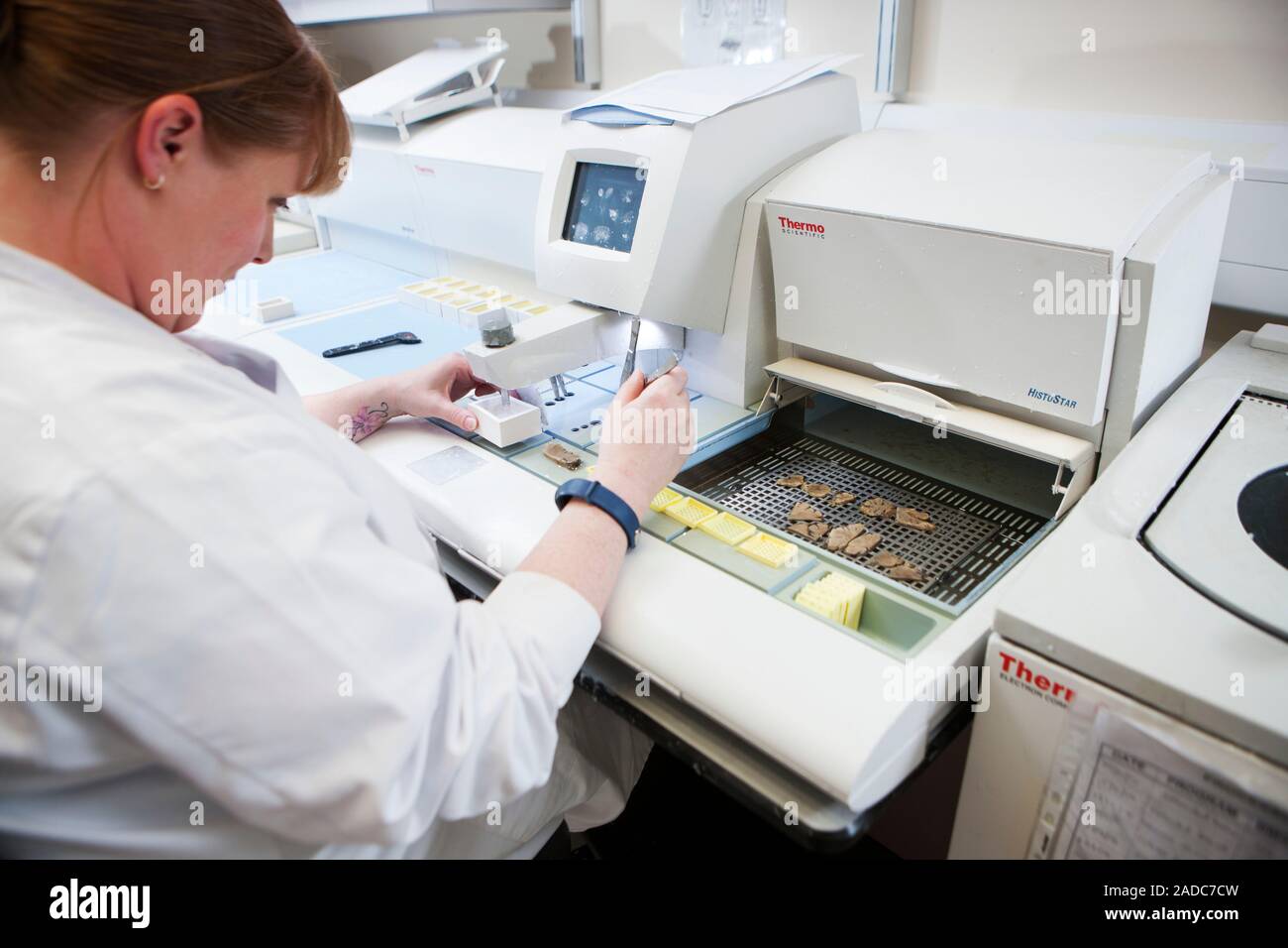 Brain specimen preparation. Forensic laboratory technician embedding