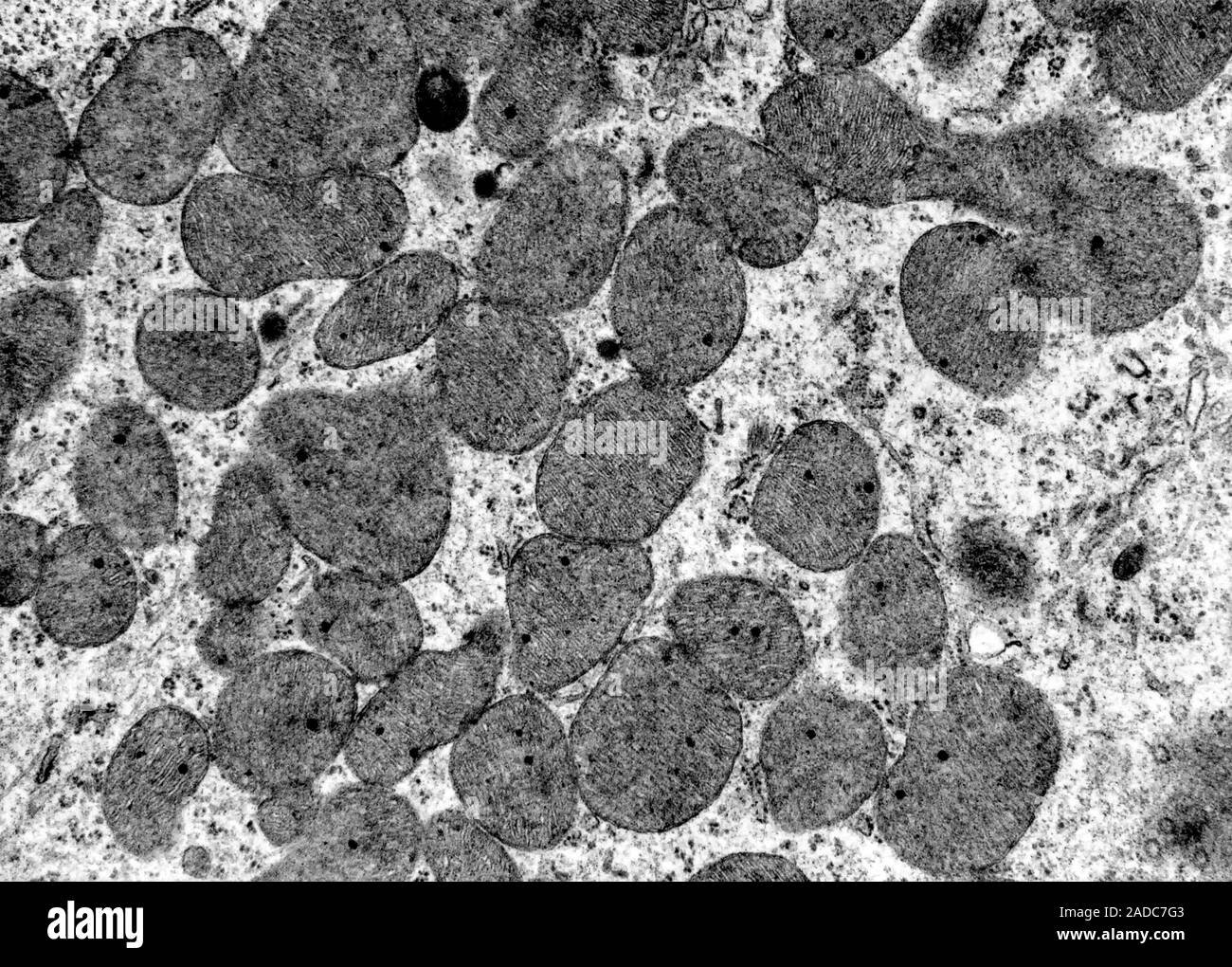 Transmission electron micrograph (TEM) showing mitochondria with ...