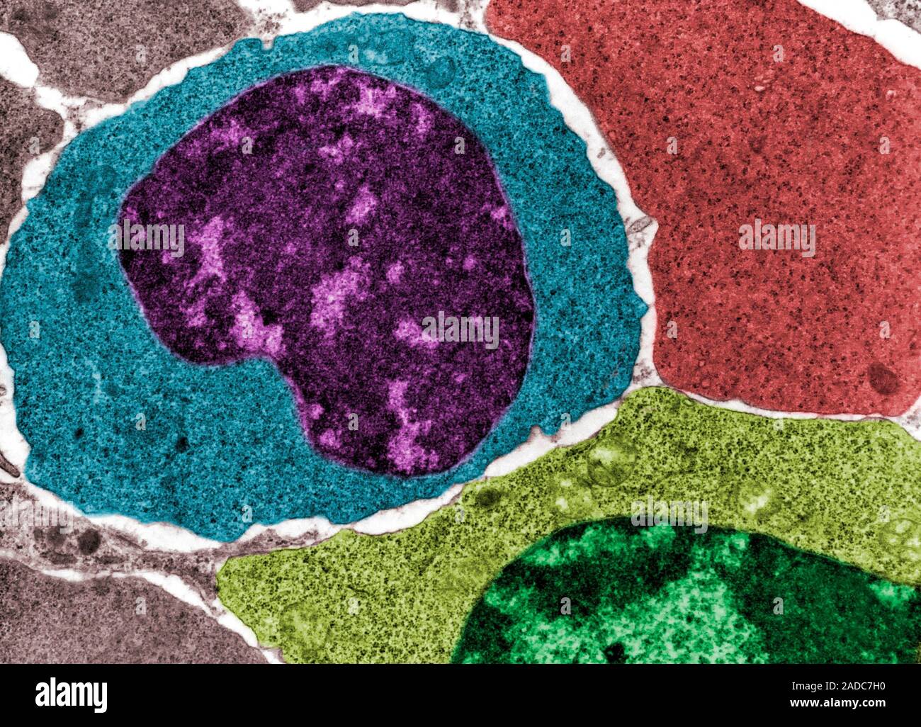 False colour transmission electron micrograph (TEM) showing three ...
