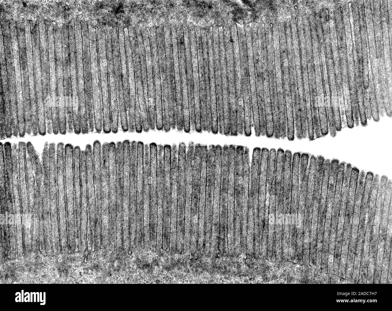 Transmission electron micrograph (TEM) showing a brush border in